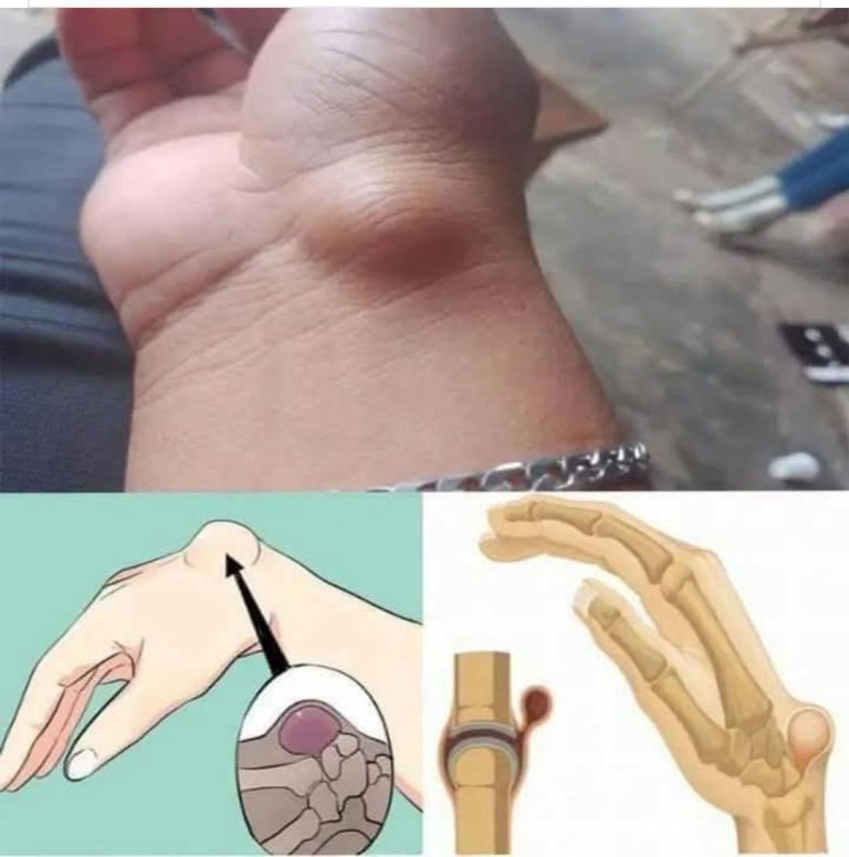 494731446 122192589662129107 8166220997422990823 N